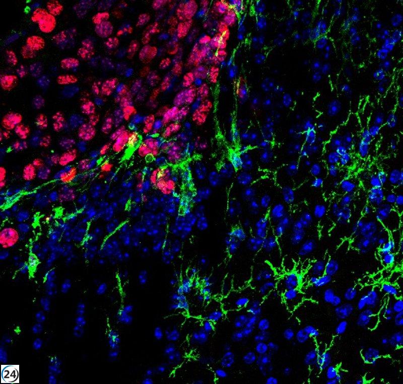 Hallan enfoque innovador para frenar metástasis cerebrales en cáncer cutáneo agresivo.