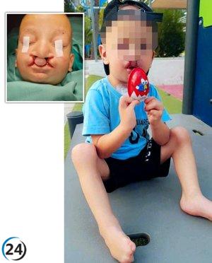 Niño de 3 años, con extraña enfermedad, logra cientos de masticadas tras intervención médica innovadora