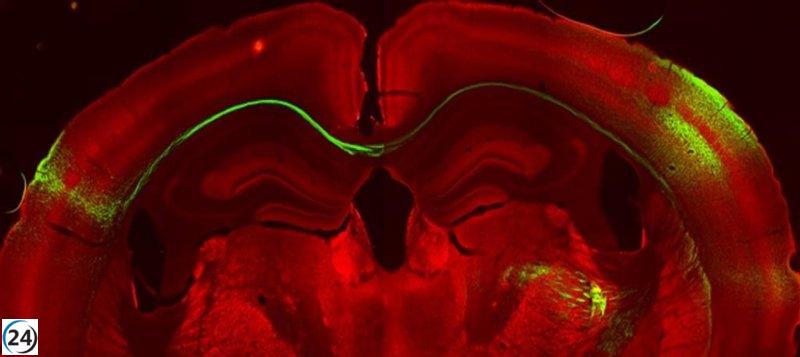 Nuevo estudio revela cómo se transmiten los estímulos sensoriales entre los hemisferios cerebrales